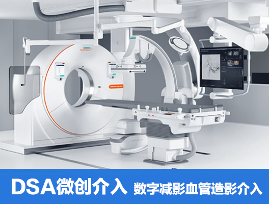 DSA微创介入